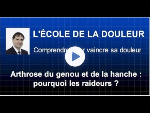 Arthrose du genou et de la hanche : pourquoi les raideurs ?