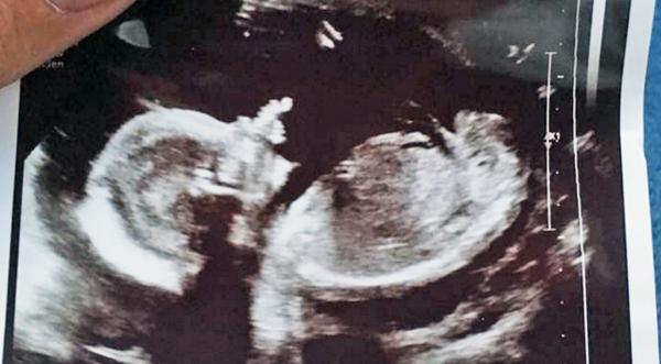 Country Singer Reveals The Gender Of First Baby