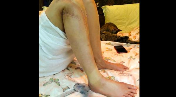 Ashley Judd Shares Update On Recovery After Leg Injury