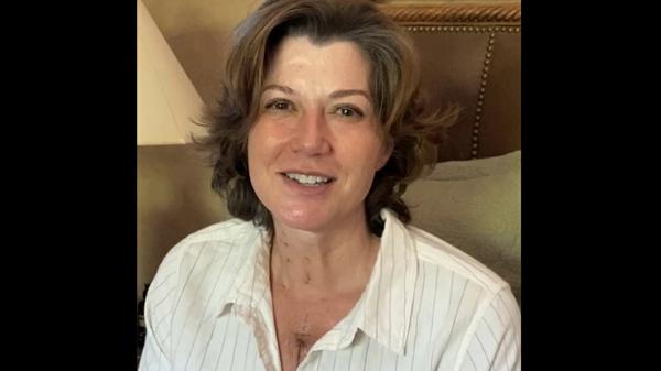 Amy Grant Shares Photos Of Scar After Undergoing Open Heart Surgery