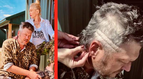 Quarantined Blake Shelton Brings His Mullet Back