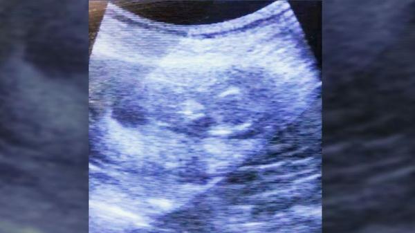 Grammy Award-Winning Singer From Beloved Country Duo Announces Pregnancy