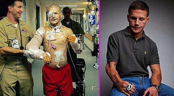 The Man Who Jumped On Grenade To Save Fellow Marine – Story Behind Cpl. Kyle Carpenter